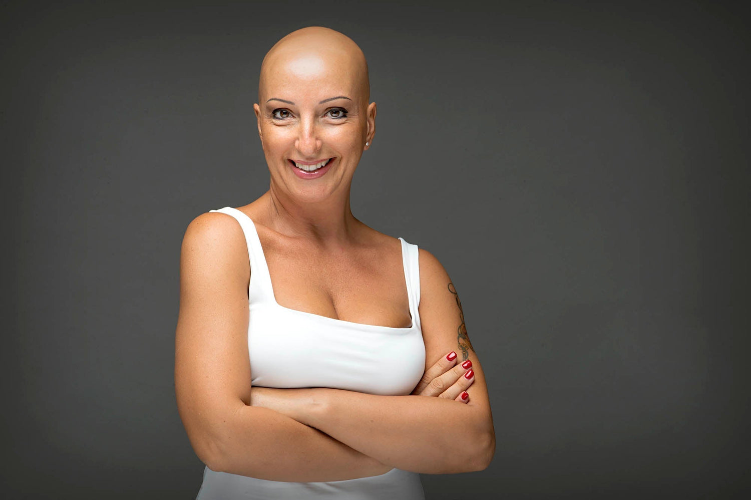 Alopecia Areata (AA): di cosa si tratta?