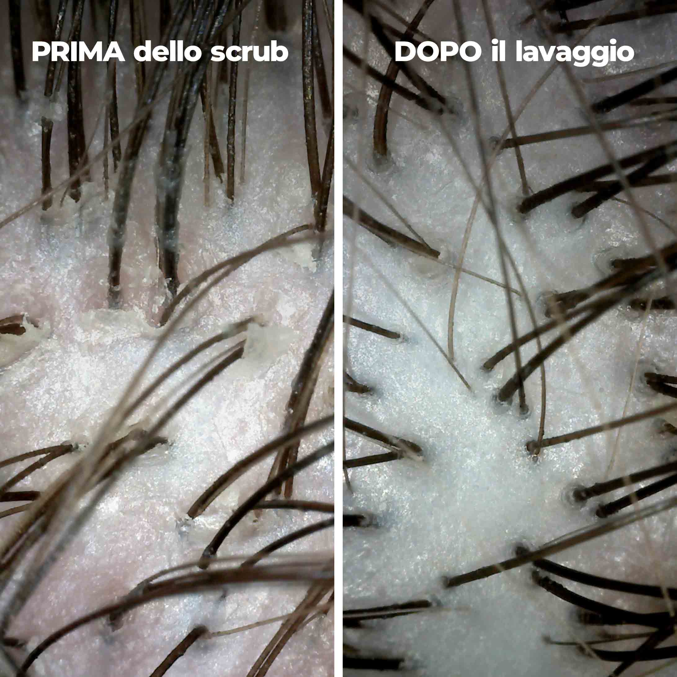 Purifica: trattamento pre-shampoo esfoliante 180ml