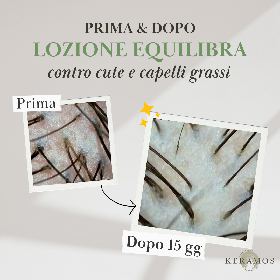 EQUILIBRA Lozione spray sebo-normalizzante per cuoio capelluto