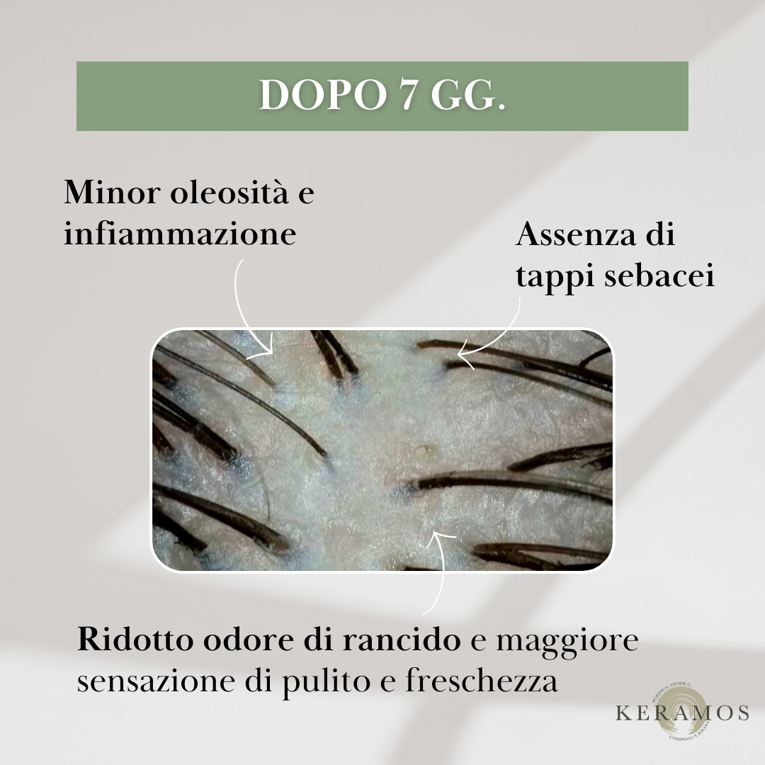 EQUILIBRA Lozione spray sebo-normalizzante per cuoio capelluto