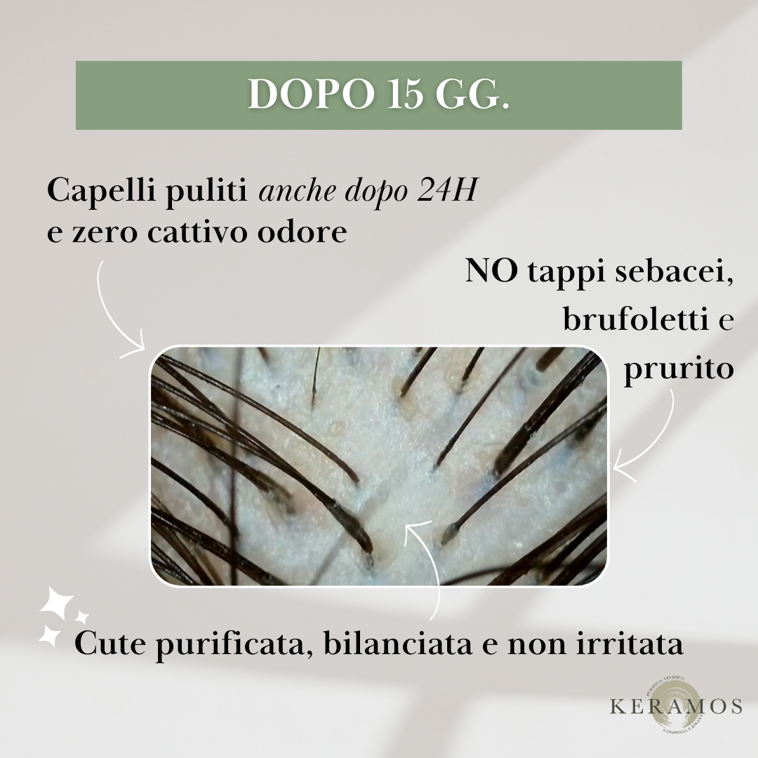 EQUILIBRA Lozione spray sebo-normalizzante per cuoio capelluto