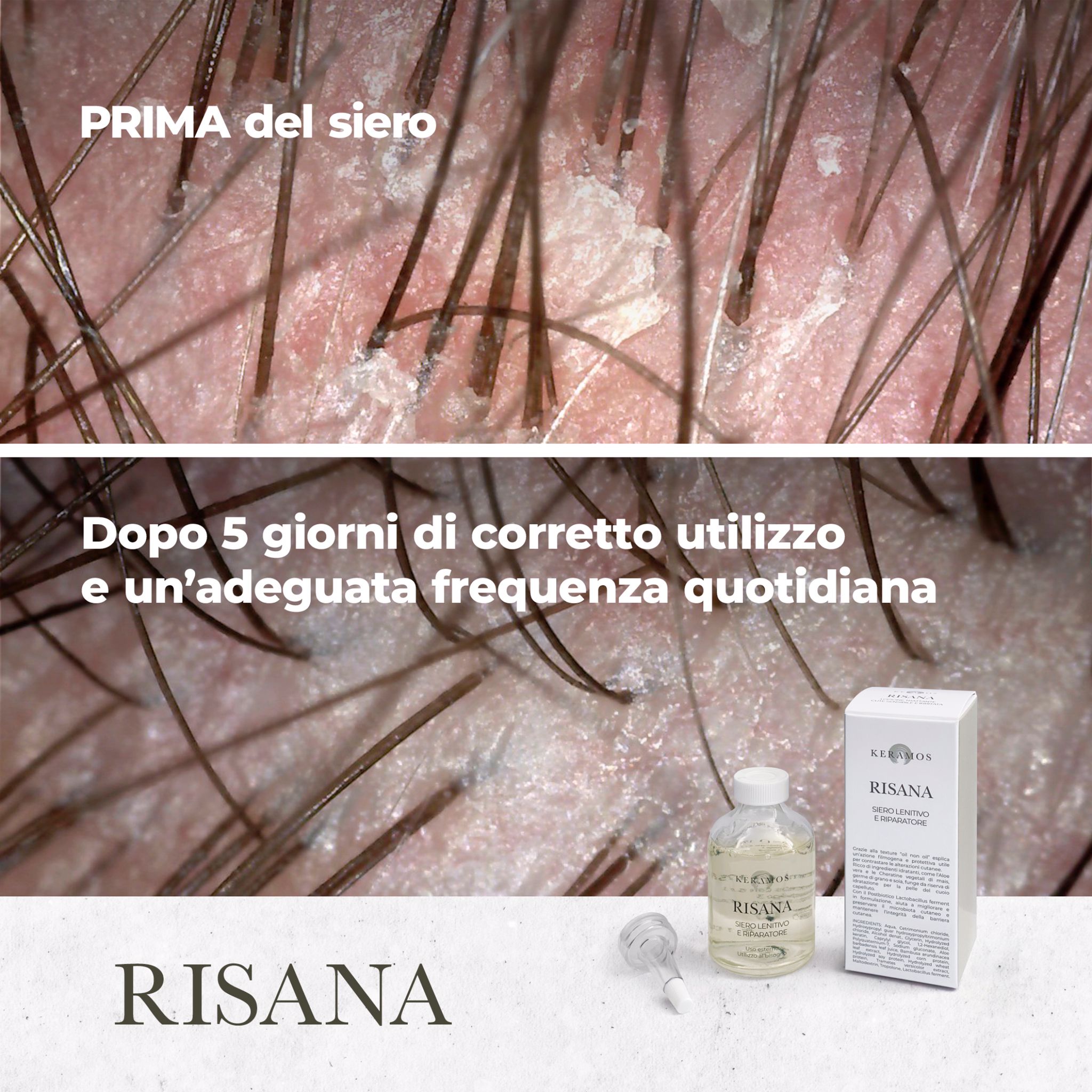 Risana: siero lenitivo e riparatore 50 ml