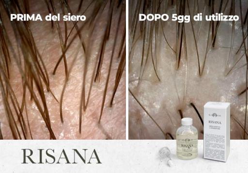 Risana: siero lenitivo e riparatore 50 ml