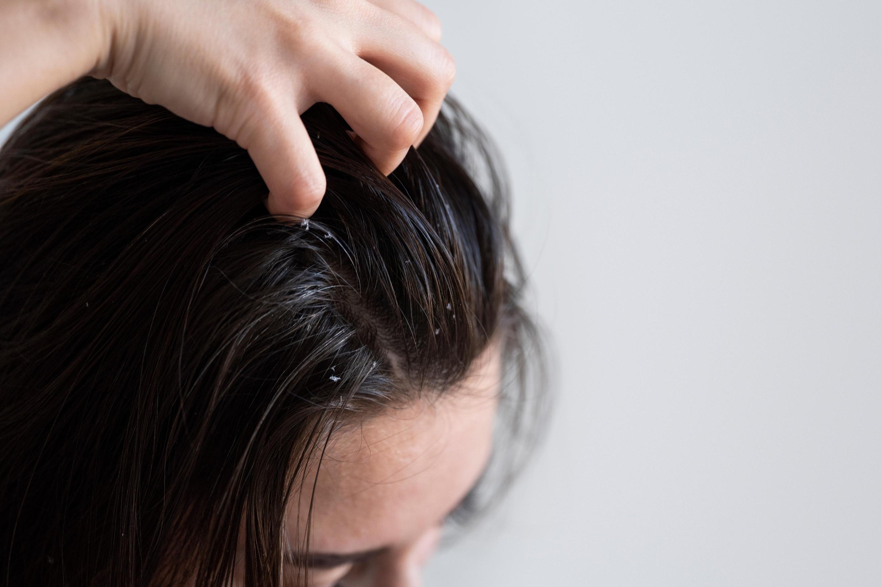 capelli.jpg